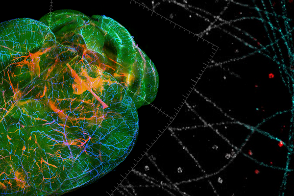 ADVANCED DEEP LEARNING FOR IMAGE ANALYSIS EMBL visual data 7